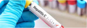 Hepatitis C virus in people who inject drugs (PWID): Regional Webinar